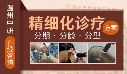溫州哪里治療白癜風