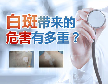 溫州看白癜風哪家好